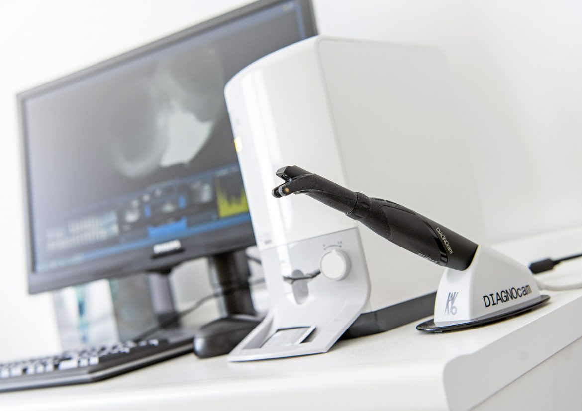 Studio dentistico tecnologico: la DIAGNOcam