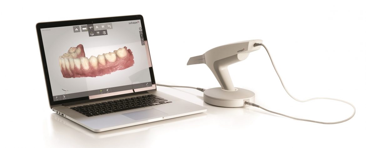 Studio dentistico tecnologico: lo scanner INTRAorale